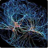 Neuron (Brain Cell) Loss