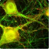 Accumulation of Everyday Toxins